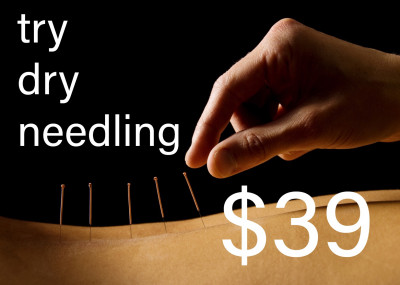 dry-needling-corconnect