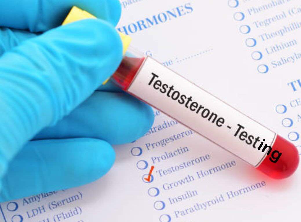 Testing Testosterone